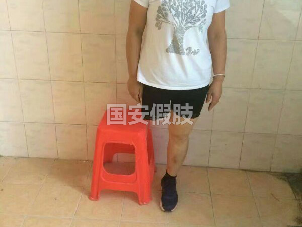 長沙國安假肢康復(fù)用品有限公司,長沙假肢用品,國安假肢康復(fù)用品,假肢矯形器,康復(fù)器材,假肢配件,矯形器支具